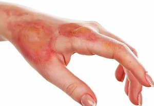 Thông tắc cống tại phường Kim Mã quận Ba Đình - Hà Nội Urenco:
Có nên dùng axit thông cống không? Những lưu ý an toàn